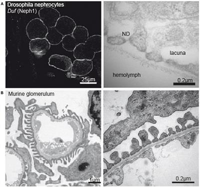 Experimental Models to Study Podocyte Biology: Stock-Taking the Toolbox of Glomerular Research